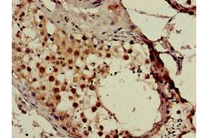 Immunohistochemistry of paraffin-embedded human testis tissue using ABIN7171024 at dilution of 1:100 (SMN1 抗体  (AA 3-194))