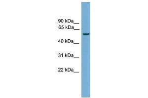 WB Suggested Anti-Ecsit Antibody Titration:  0. (ECSIT 抗体  (N-Term))
