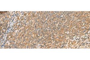 Immunohistochemistry of paraffin-embedded Human tonsil tissue using SCRN2 Polyclonal Antibody at dilution of 1:60(x200) (SCRN2 抗体)