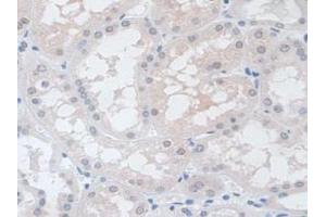 IHC-P analysis of Human Kidney Tissue, with DAB staining. (VCP 抗体  (AA 125-371))