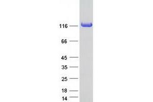 Validation with Western Blot