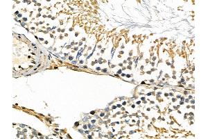 ABIN6257420 and ABIN6275854 at 1/100 staining Rat testis tissue by IHC-P. (PKN1 抗体  (Internal Region))