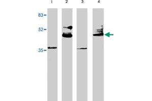 Western blot analysis using VSX2 polyclonal antibody at 1 ug/mL on rat liver (lane 1), retina tissue lysate (lane 2), mouse liver (lane 3) and retina (lane 4) tissue lysate. (VSX2 抗体  (AA 264-361))