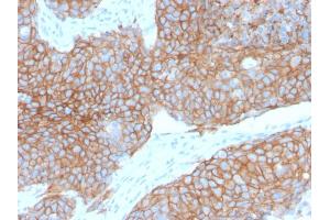 Formalin-fixed, paraffin-embedded human Cervix stained with E-Cadherin Rabbit Recombinant Monoclonal Antibody (CDH1/2208R).