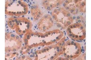 IHC-P analysis of Human Kidney Tissue, with DAB staining. (LOXL4 抗体  (AA 399-552))