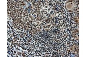 Immunohistochemical staining of paraffin-embedded Kidney tissue using anti-RC211175 mouse monoclonal antibody. (TUBA8 抗体)