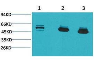 Western Blotting (WB) image for anti-Mitochondrial Calcium Uptake 1 (MICU1) antibody (ABIN3179096) (MICU1 抗体)
