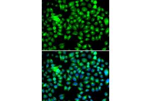 Immunofluorescence (IF) image for anti-Heat Shock 22kDa Protein 8 (HSPB8) (AA 1-196) antibody (ABIN3016167) (HSPB8 抗体  (AA 1-196))