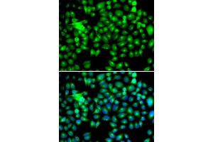 Immunofluorescence (IF) image for anti-Heat Shock 22kDa Protein 8 (HSPB8) (AA 1-196) antibody (ABIN3016167) (HSPB8 抗体  (AA 1-196))