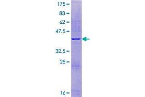 TOR1AIP2 Protein (AA 1-131) (GST tag)