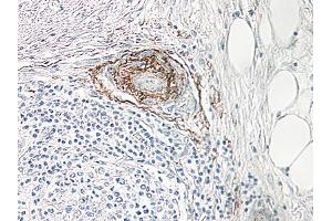 Image no. 1 for anti-Nerve Growth Factor (NGF) antibody (ABIN465644) (Nerve Growth Factor 抗体)