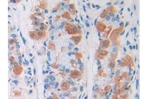 Immunohistochemistry (IHC) image for anti-Permeability Glycoprotein (AA 394-672) antibody (ABIN7433945)