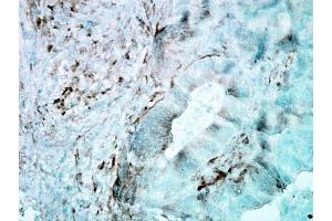 Immunohistochemistry analysis using Mouse Anti-Hsp27 Monoclonal Antibody, Clone 8A7 . (HSP27 抗体  (HRP))