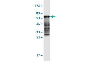 Western Blotting (WB) image for anti-Caudal Type Homeobox 2 (CDX2) (AA 1-313) antibody (ABIN2565434)