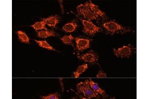 Immunofluorescence analysis of C6 cells using PASK Polyclonal Antibody at dilution of 1:100. (PASK 抗体)