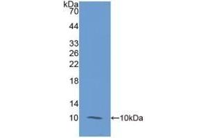 Detection of Recombinant S100A12, Human using Monoclonal Antibody to S100 Calcium Binding Protein A12 (S100A12) (S100A12 抗体  (AA 1-92))