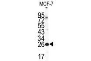 Image no. 1 for anti-Neuronal Calcium Sensor 1 (NCS1) (Center) antibody (ABIN357105) (NCS1 抗体  (Center))