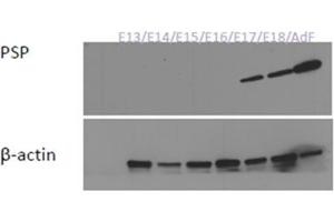 Western Blotting (WB) image for anti-Syntaxin Binding Protein 3 (STXBP3) (AA 146-160), (Internal Region) antibody (ABIN1108779) (STXBP3 抗体  (Internal Region))