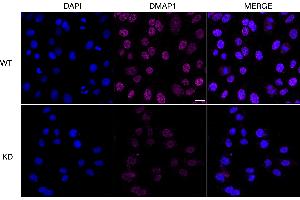 anti-DNA Methyltransferase 1-Associated Protein 1 (DMAP1) antibody