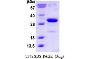SDS-PAGE (SDS) image for Cyclin-Dependent Kinase Inhibitor 1B (p27, Kip1) (CDKN1B) (AA 1-198) protein (His tag) (ABIN667591) (CDKN1B Protein (AA 1-198) (His tag))