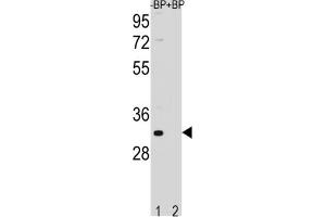 Western Blotting (WB) image for anti-Family with Sequence Similarity 26, Member F (FAM26F) antibody (ABIN3004478) (FAM26F 抗体)