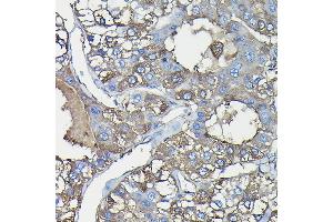 Immunohistochemistry (IHC) image for anti-Ferritin, Heavy Polypeptide 1 (FTH1) (AA 1-183) antibody (ABIN3021539)