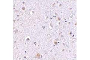 Immunohistochemistry of NUP160 in human brain tissue with NUP160 antibody at 2. (NUP160 抗体  (C-Term))