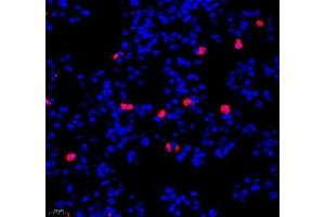 Immunofluorescence of paraffin embedded mouse lung using IL-23R (ABIN7074355) at dilution of 1:200 (400x lens) (IL23R 抗体)