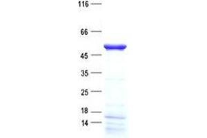 Validation with Western Blot
