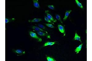 Immunofluorescent analysis of Hela cells using ABIN7142940 at dilution of 1:100 and Alexa Fluor 488-congugated AffiniPure Goat Anti-Rabbit IgG(H+L)