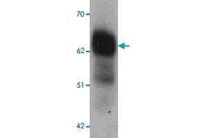 Western blot analysis of DYRK2 in 293 cell lysate with DYRK2 polyclonal antibody  at 1 ug/mL (lane 1) and 2 ug/mL (lane 2). (DYRK2 抗体  (C-Term))