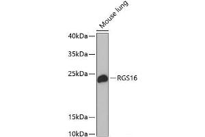 Western blot analysis of extracts of Mouse lung using RGS16 Polyclonal Antibody at dilution of 1:1000. (RGS16 抗体)