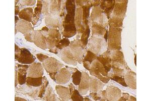 Paraformaldehyde-fixed, paraffin embedded mouse skeletal muscle, Antigen retrieval by boiling in sodium citrate buffer (pH6) for 15min, Block endogenous peroxidase by 3% hydrogen peroxide for 30 minutes, Blocking buffer at 37°C for 20min, Antibody incubation with Glycogen synthase 1(S641) (10C1) Monoclonal Antibody  at 1:50 overnight at 4°C, followed by a conjugated secondary and DAB staining. (Glycogen Synthase 1 抗体  (pSer641))
