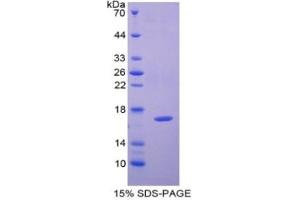 SDS-PAGE of Protein Standard from the Kit (Highly purified E. (CAP2 ELISA 试剂盒)