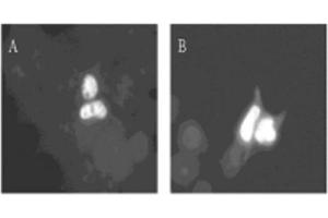 Image no. 1 for anti-Dual-Specificity tyrosine-(Y)-phosphorylation Regulated Kinase 1A (DYRK1A) (AA 486-763) antibody (ABIN297140)