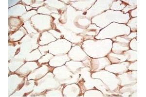 Rat visceral fat tissue was stained by Rabbit Anti-Adiponutrin (436-481) (Human) Serum (PNPLA3 抗体  (AA 436-481))