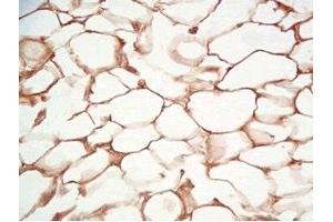 Rat visceral fat tissue was stained by Rabbit Anti-Adiponutrin (436-481) (Human) Serum (PNPLA3 抗体  (AA 436-481))
