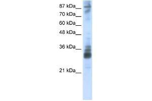 WB Suggested Anti-RG9MTD2 Antibody Titration:  2. (RG9MTD2 抗体  (Middle Region))