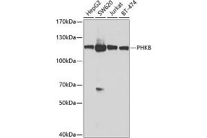 Western blot analysis of extracts of various cell lines, using PHKB antibody (ABIN6129077, ABIN6145560, ABIN6145561 and ABIN6224038) at 1:1000 dilution. (PHKB 抗体  (AA 854-1093))
