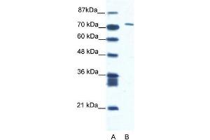 Human Jurkat; WB Suggested Anti-CXORF6 Antibody Titration: 1. (MAMLD1 抗体  (N-Term))