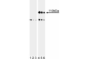Western blot analysis of Rb (pS807/pS811) in human embryonic skin cells. (Retinoblastoma 1 抗体  (pSer807))
