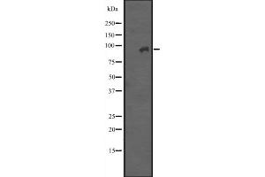 Western blot analysis of ITGB7 expression in A431 whole cell lysate ,The lane on the left is treated with the antigen-specific peptide. (Integrin beta 7 抗体  (Internal Region))