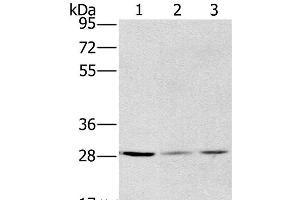 Western Blot analysis of A375, hela and A172 cell using HSD17B12 Polyclonal Antibody at dilution of 1:570 (HSD17B12 抗体)