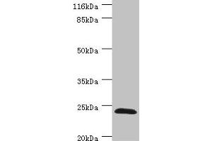 Western blot All lanes: GSTZ1 antibody at 0. (GSTZ1 抗体  (AA 1-216))