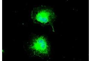 Anti-CTAG1B mouse monoclonal antibody (ABIN2452329) immunofluorescent staining of COS7 cells transiently transfected by pCMV6-ENTRY CTAG1B (RC213318). (CTAG1B 抗体)