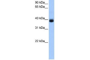 WB Suggested Anti-SERPINA5 Antibody Titration: 0. (SERPINA5 抗体  (C-Term))