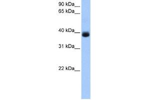 WB Suggested Anti-SERPINA5 Antibody Titration: 0.