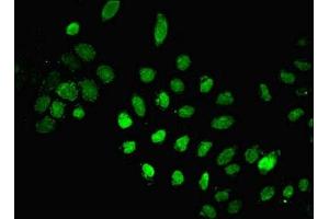 Immunofluorescent analysis of A549 cells using ABIN7150189 at dilution of 1:100 and Alexa Fluor 488-congugated AffiniPure Goat Anti-Rabbit IgG(H+L) (LIG1 抗体  (AA 1-919))