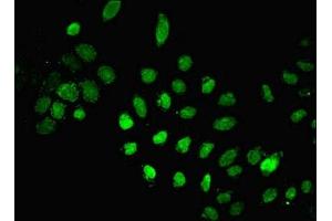 Immunofluorescent analysis of A549 cells using ABIN7150189 at dilution of 1:100 and Alexa Fluor 488-congugated AffiniPure Goat Anti-Rabbit IgG(H+L) (LIG1 抗体  (AA 1-919))