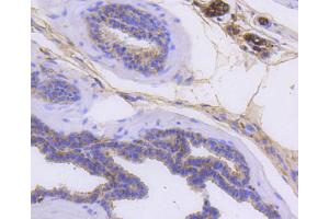 Paraformaldehyde-fixed, paraffin embedded mouse prostate, Antigen retrieval by boiling in sodium citrate buffer (pH6) for 15min, Block endogenous peroxidase by 3% hydrogen peroxide for 30 minutes, Blocking buffer at 37°C for 20min, Antibody incubation with Cytokeratin 14 (2F11) Monoclonal Antibody  at 1:50 overnight at 4°C, followed by a conjugated secondary and DAB staining. (KRT14 抗体)